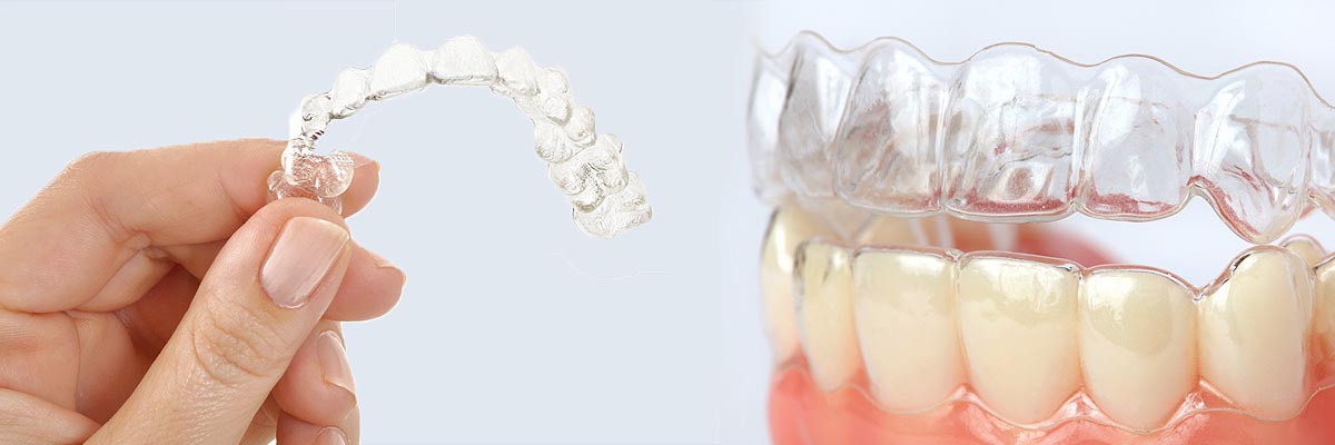 Delaware Alternative to Braces for Teens