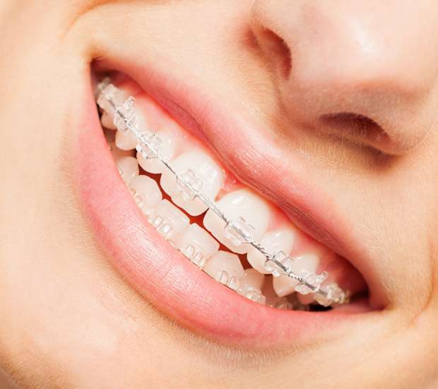 Delaware Invisible Orthodontics