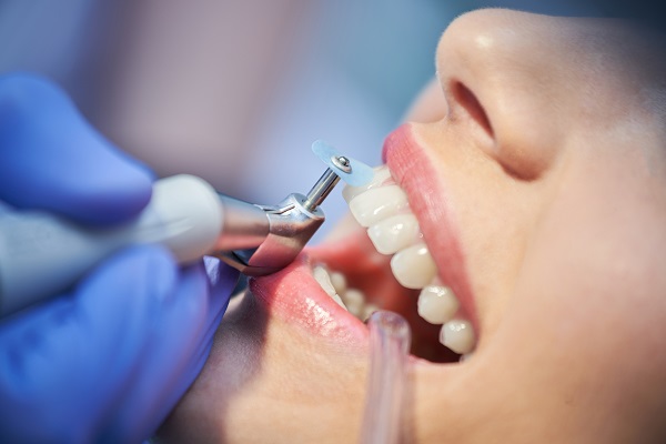 Gum Therapy &# ; What Happens In A Deep Teeth Cleaning?