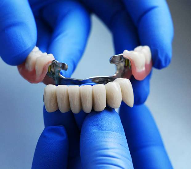 Sexton Dental Bridges