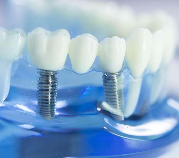 Sexton Dental Prosthetics