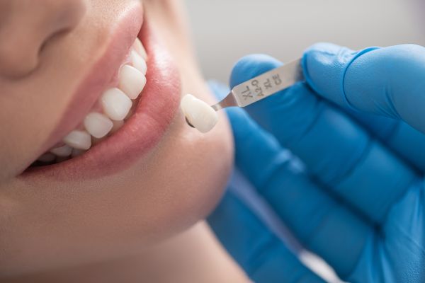 Learn How A Veneers Dentist In Delaware Can Transform Your Smile