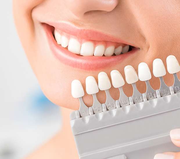 Delaware Veneers
