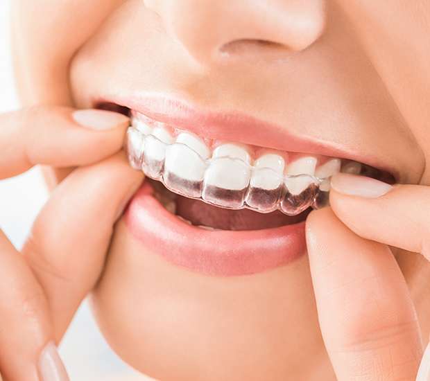 Delaware Does Invisalign® Really Work?