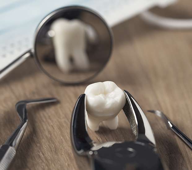 Delaware When Is a Tooth Extraction Necessary